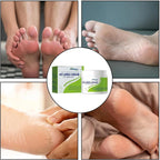 South Moon - 42% Urea Cream + 2% Salicylic Acid (Original)